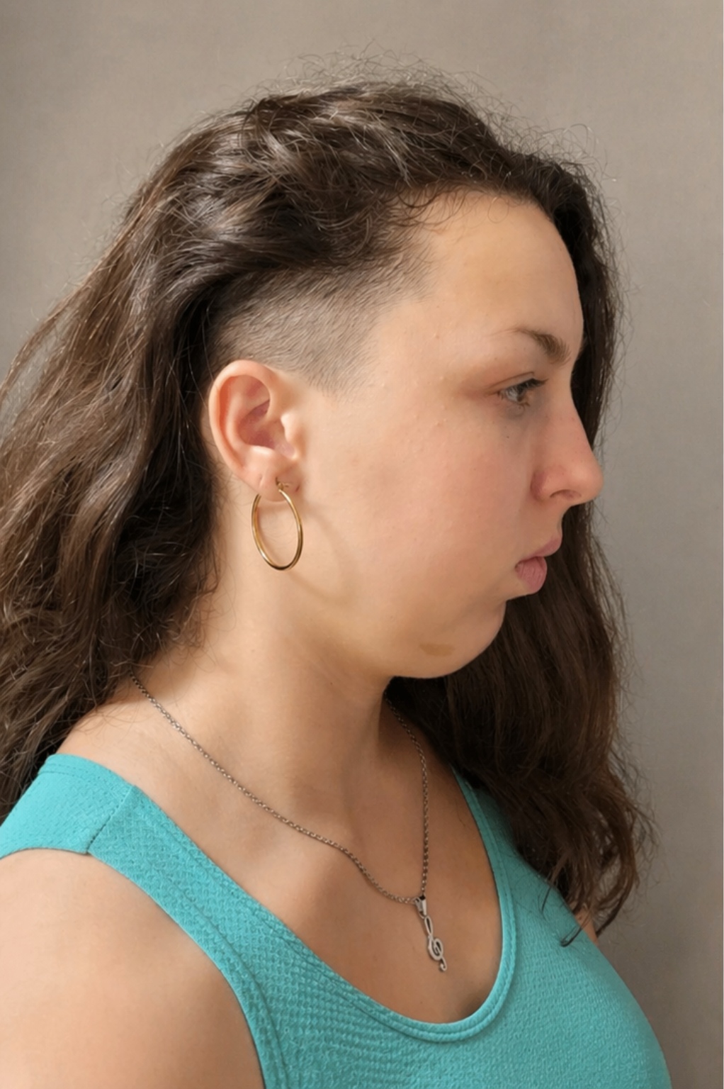 Antes papada y perfil