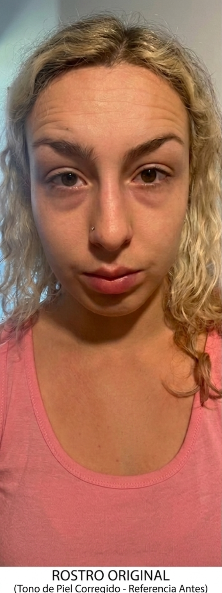 Antes ojeras