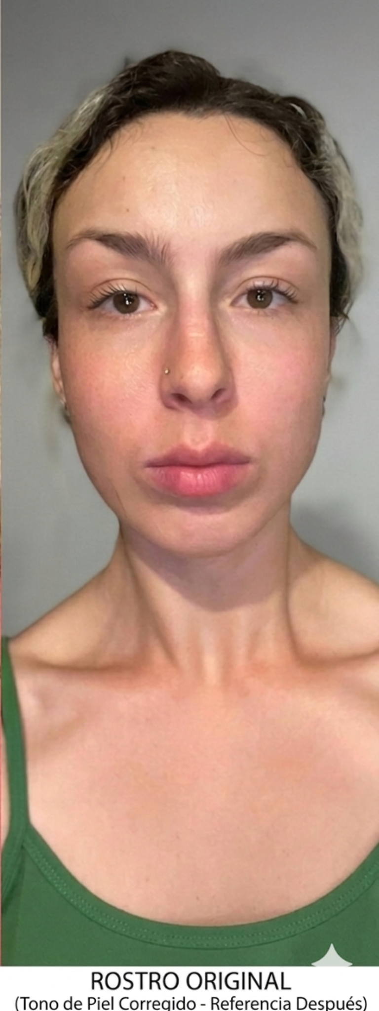 Después ojeras